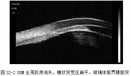 ZY016_164_3.gif